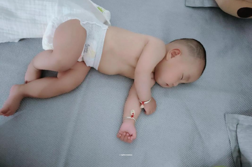 滁州宝宝头上长痱子